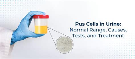 normal range of pus cells in urine|Pus Cells in Urine: Normal Range, Causes,.